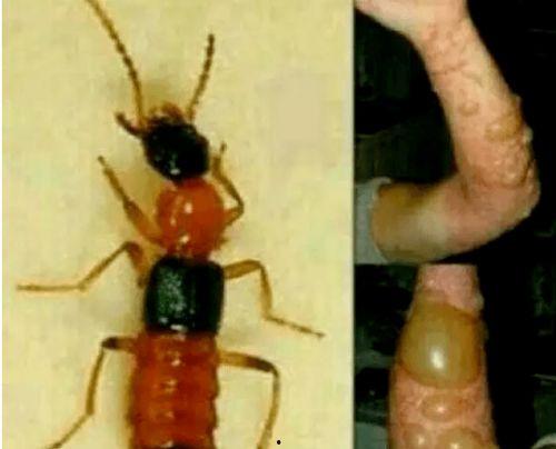 昆虫皮肤动作爆料视频下载,动作视频背后的科学奥秘